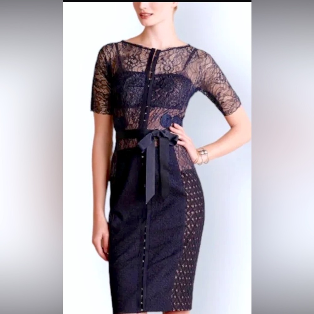 Bryon Lars Beguile Lace Dress- Anthropologie
